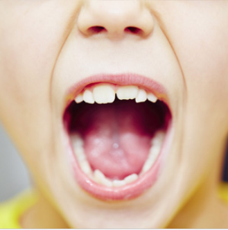 mouth wide open