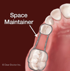 foot with space maintainer