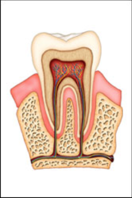 root canals