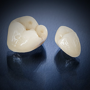 dental crowns