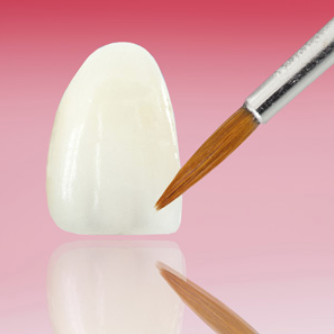 veneers