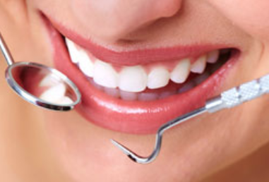 Veneers