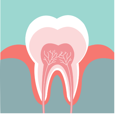 root canal