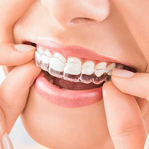 Retainer