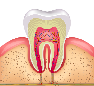 root canal